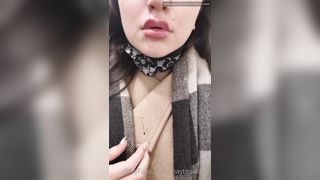 May Teodosio Had My Lips Done Yesterday What Do You Think They Were So Swollen