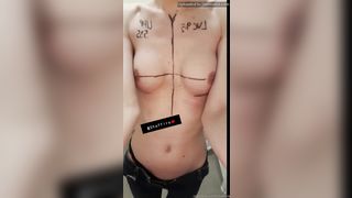 Shaffire Little Update New Boobs Cant See Much Cos All Wrapped The Support Bra But